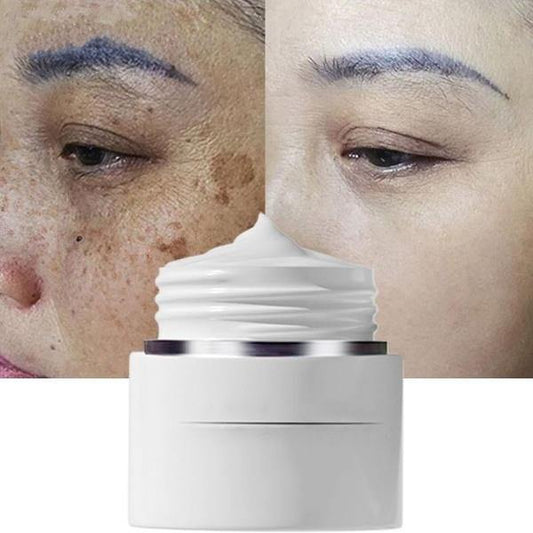 Dark Spot Corrector Cream - YGME Store